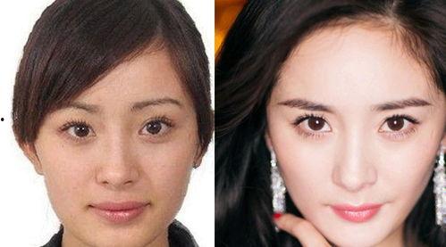 娱乐圈隆鼻的明星,揭秘那些美丽背后的秘密