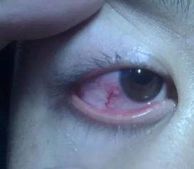 眼睛哭肿图片,捕捉哭泣时刻的深情瞬间